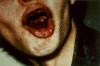 thumb 70